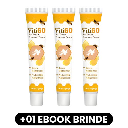 VitiGO - Creme de Tratamento para Vitiligo - Mania das CoisasVitiGO - Creme de Tratamento para VitiligoMania das Coisas