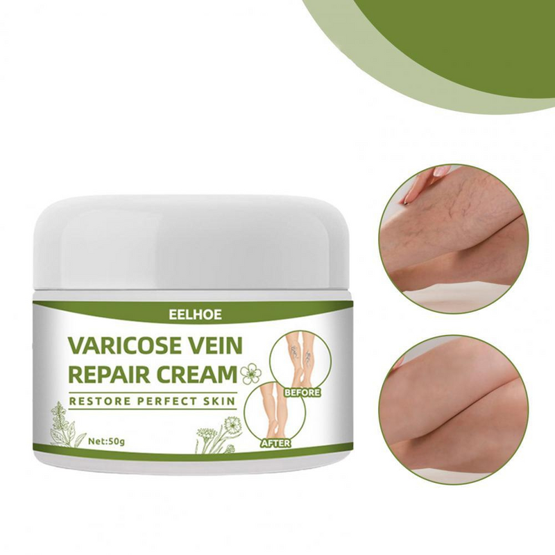 Creme para tratamento de varizes + BRINDE